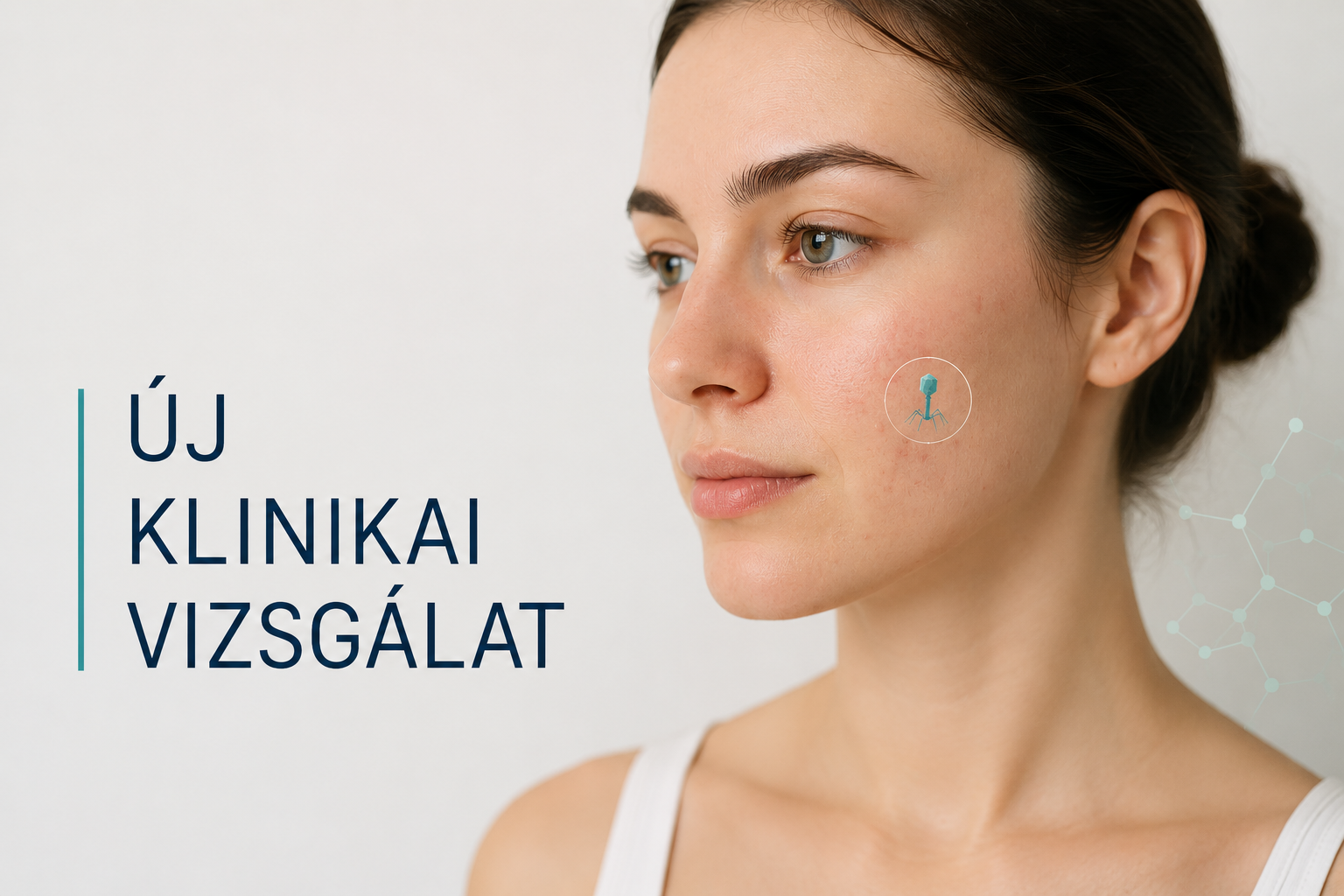 Izgalmas új klinikai vizsgálat a bakteriofágokról és a pattanásokról